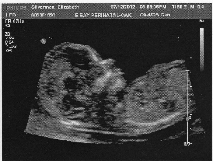 Malcolm Ultrasound